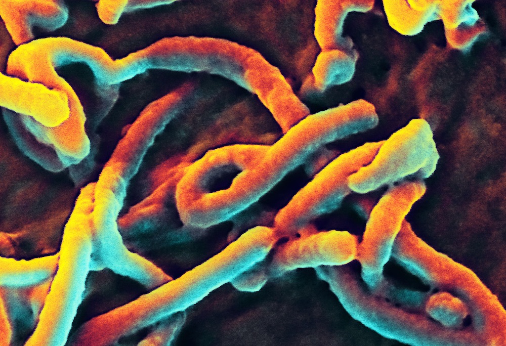 ebola-filaments-141005.jpg